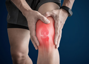 ¿Qué es la bursitis de la rodilla? ¡Cuidado con estos síntomas!