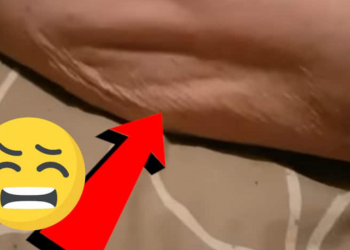 Por qué dan calambres en todo el cuerpo