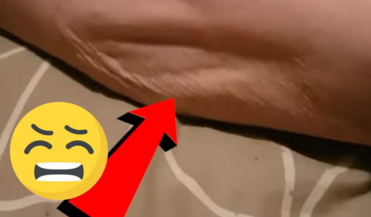 Por qué dan calambres en todo el cuerpo